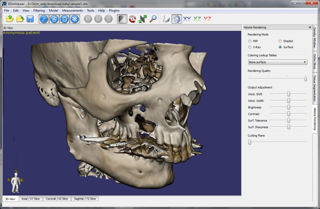 Philips dicom viewer download for mac