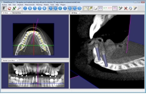 DentalViewer